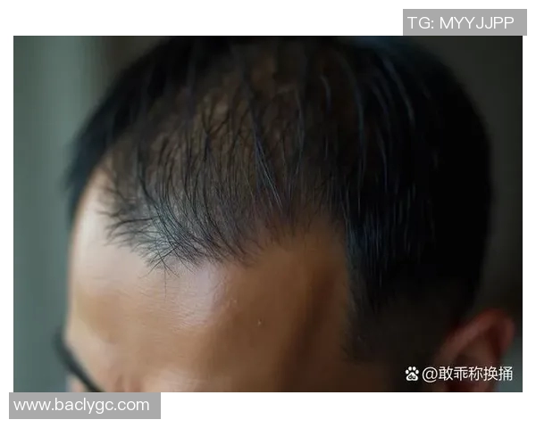 足球明星脱发现象揭秘你知道哪些球星也在为脱发烦恼吗